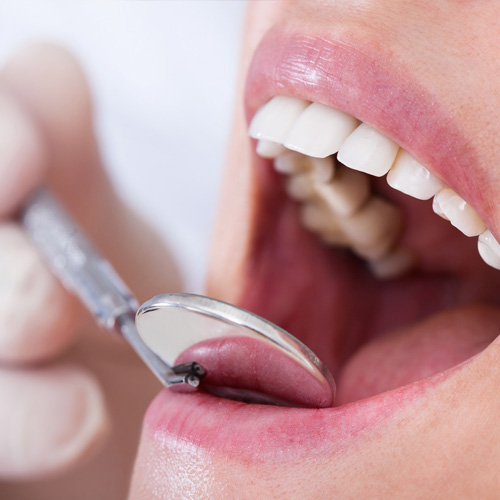 odontologia-preventiva