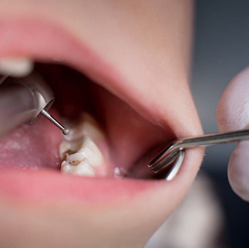 odontologia-conservadora